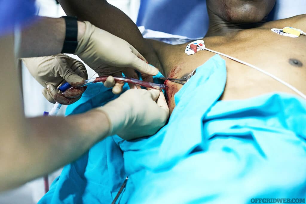 Cropped shot of a doctor inserting a tube into a patient’s chest in an emergency room