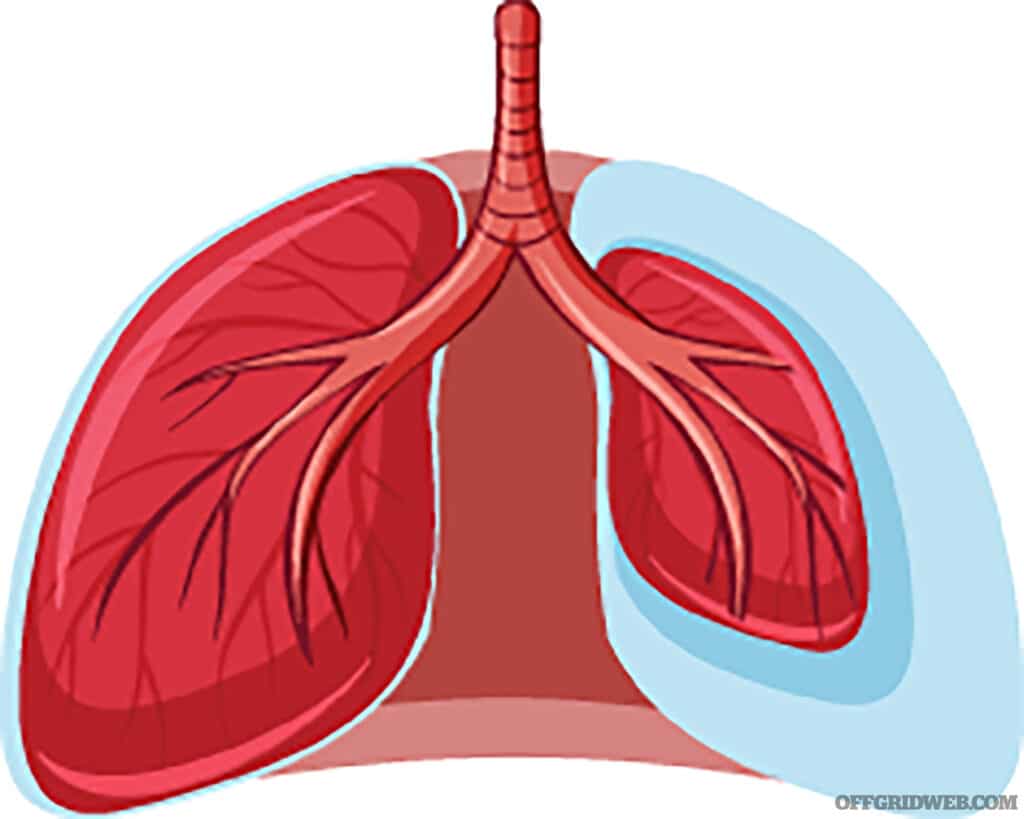 A diagram depicting a full lung vs a collapsed lung.