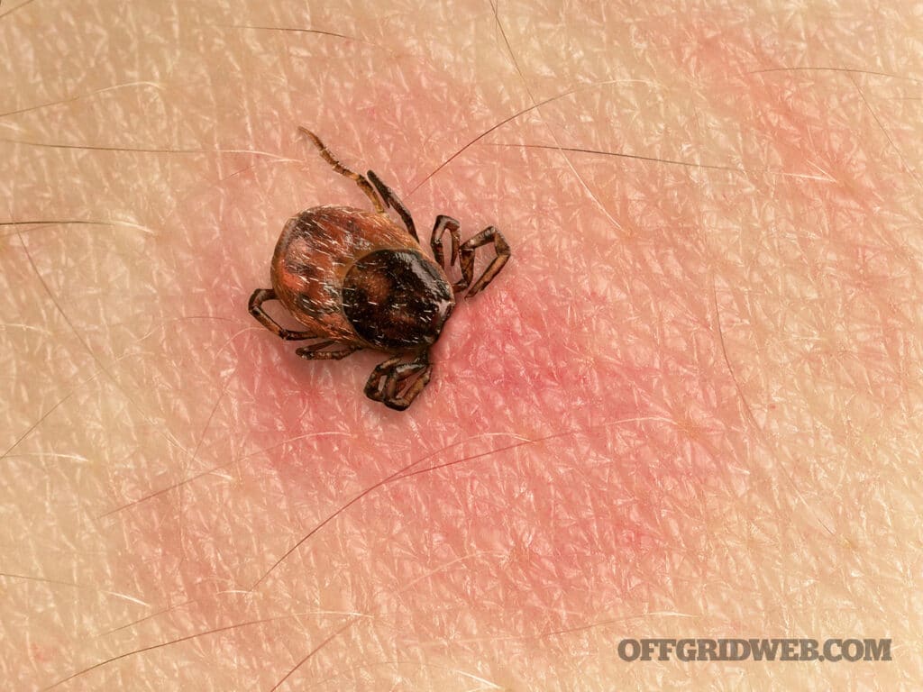 image of a tick in human skin