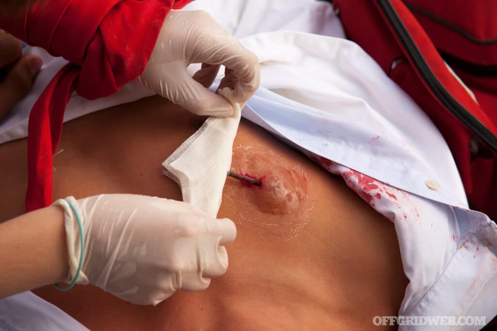 picture of the treatment of a traumatic chest injury