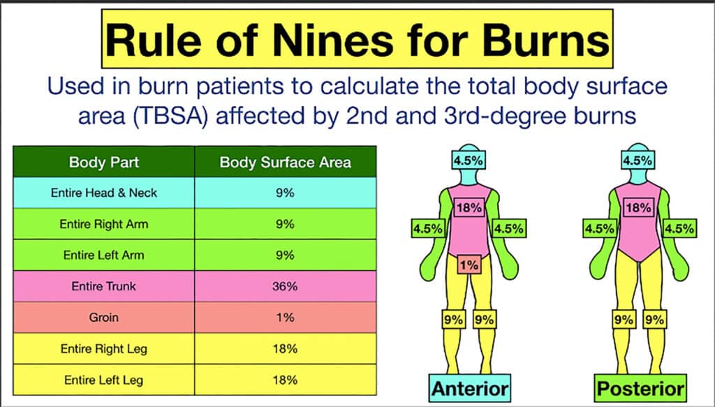 burn injury chart